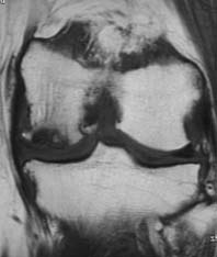 IONmri